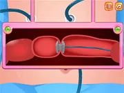 Phẫu thuật cắt bỏ đại tràng